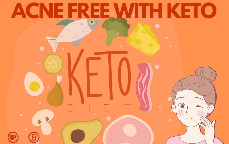 Will the Keto Diet Help Acne?